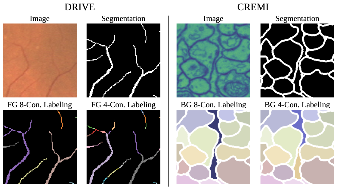 Pitfalls of topology-aware image segmentation